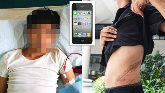 Man Sells Kidney to Get An iPhone, Ends up on Dialysis