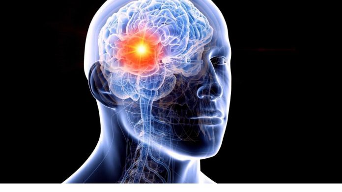 trigger brain cancer, according to experts. claim