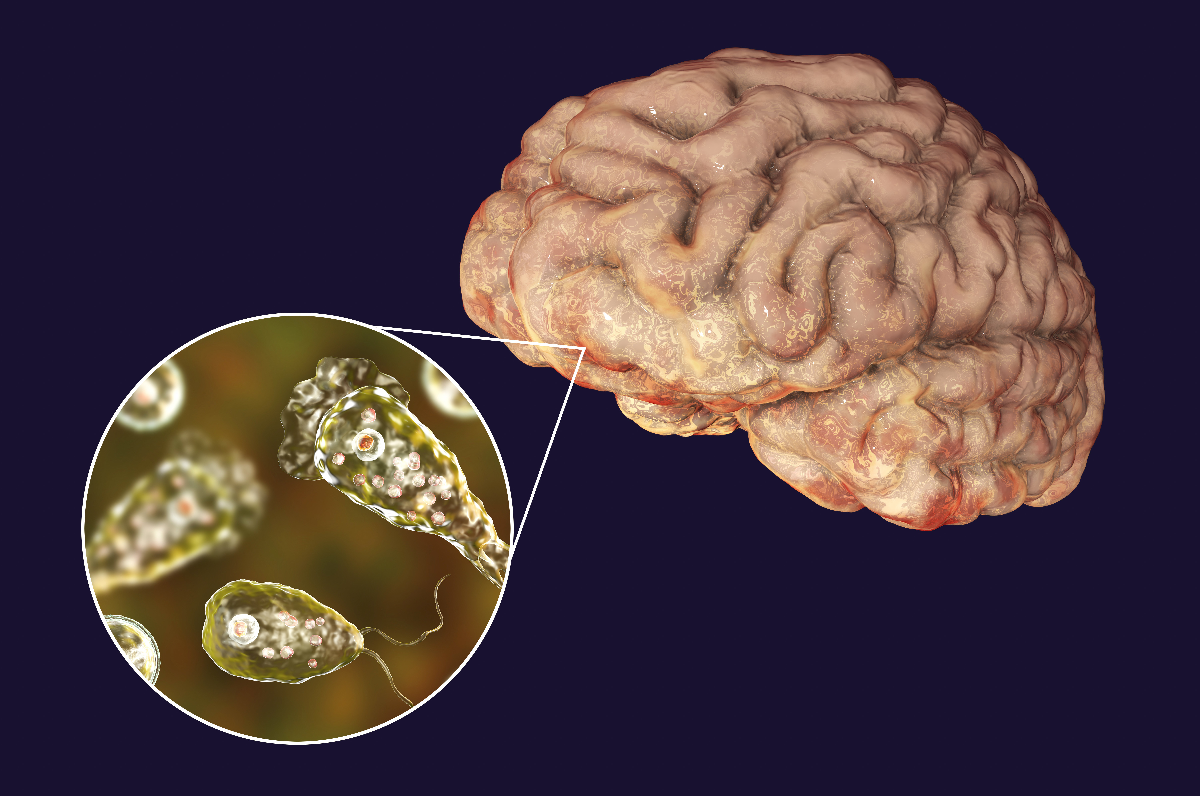 NIH Alerts Public About Lethal Brain-Eating Amoeba