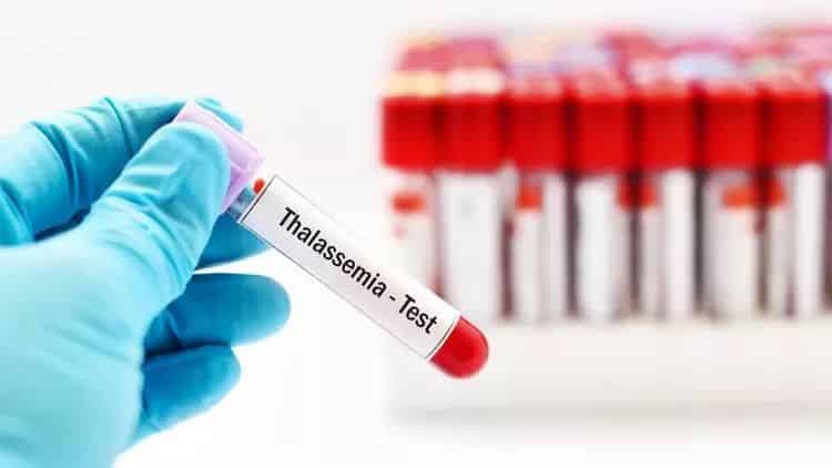 Thalassemia