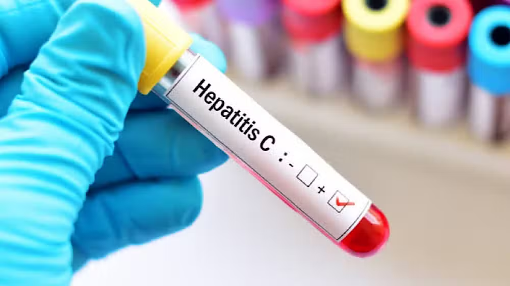 Pakistan Leads the World in Hepatitis C Cases, Urges Global Cooperation for Elimination