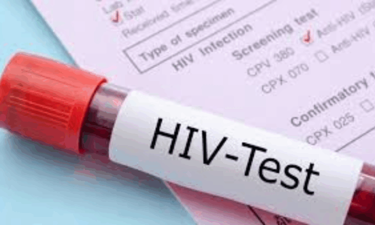 HIV
